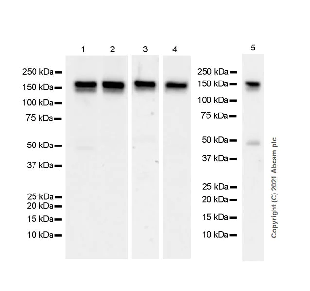 Western blot - Anti-YTHDC2 antibody [EPR24278-9] - BSA and Azide free (AB283277)