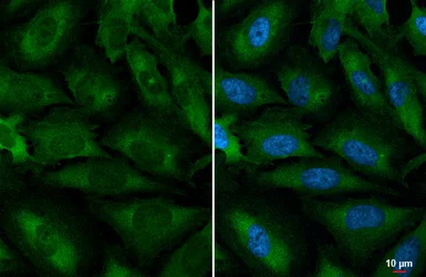 Immunocytochemistry/ Immunofluorescence - Anti-YTHDC2 antibody [HL1861] (AB308201)