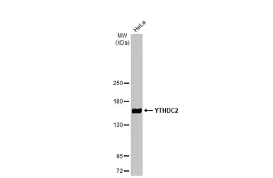 Western blot - Anti-YTHDC2 antibody [HL1861] (AB308201)