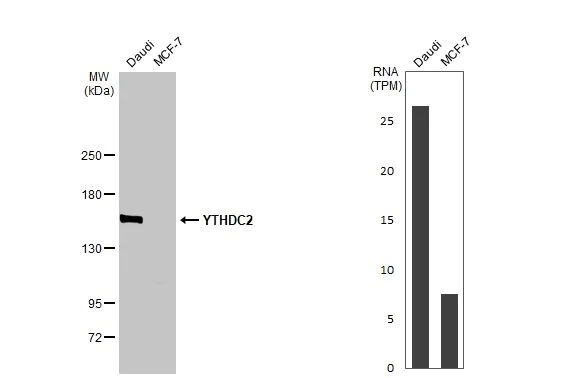 Western blot - Anti-YTHDC2 antibody [HL1861] (AB308201)