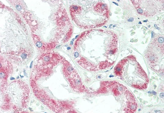 Immunohistochemistry (Formalin/PFA-fixed paraffin-embedded sections) - Anti-YTHDF1 antibody (AB230330)