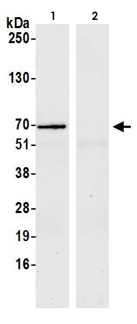 Immunoprecipitation - Anti-YTHDF1 antibody (AB264409)