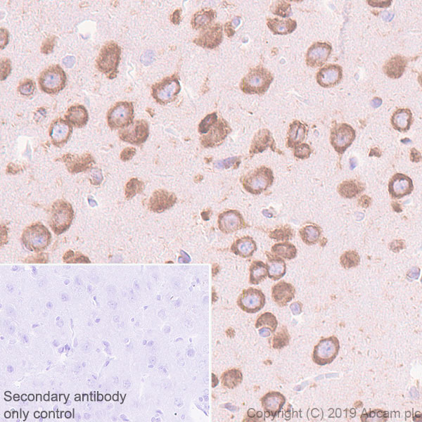 Anti-YTHDF1 antibody [EPR22349-16]