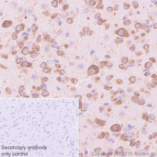 Immunohistochemistry (Formalin/PFA-fixed paraffin-embedded sections) - Anti-YTHDF1 antibody [EPR22349-16] - BSA and Azide free (AB252547)
