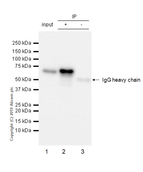 Immunoprecipitation - Anti-YTHDF1 antibody [EPR22349-41] (AB220162), expandable thumbnail