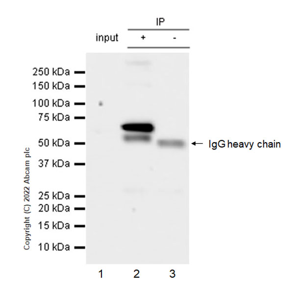 Immunoprecipitation - Anti-YTHDF1 + YTHDF3 + YTHDF2 antibody [EPR26183-69] - BSA and Azide free (AB290749), expandable thumbnail