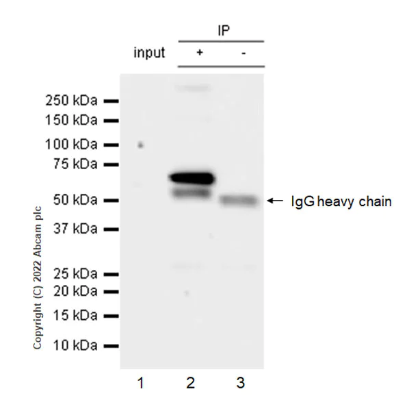Immunoprecipitation - Anti-YTHDF1 + YTHDF3 + YTHDF2 antibody [EPR26183-69] - BSA and Azide free (AB290749)