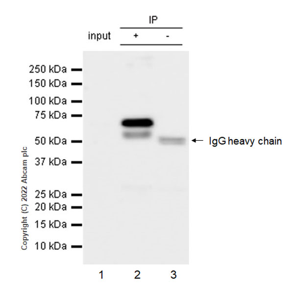 Immunoprecipitation - Anti-YTHDF1 + YTHDF3 + YTHDF2 antibody [EPR26183-69] - BSA and Azide free (AB290749), expandable thumbnail