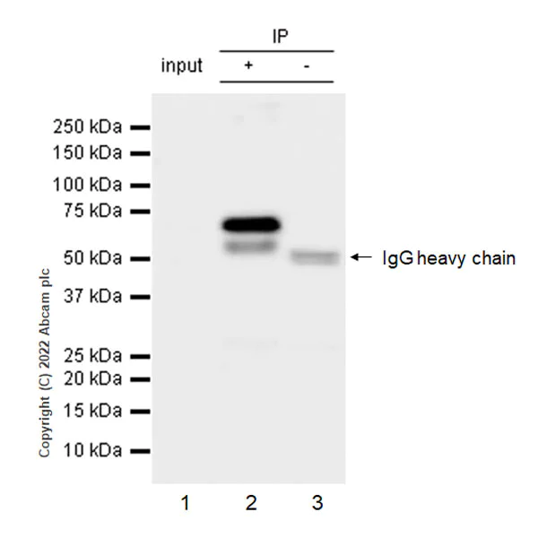 Immunoprecipitation - Anti-YTHDF1 + YTHDF3 + YTHDF2 antibody [EPR26183-69] - BSA and Azide free (AB290749)