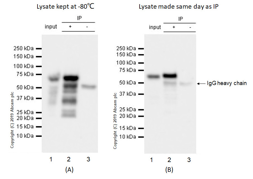 Immunoprecipitation - Anti-YTHDF2 antibody [EPR20318] (AB220163), expandable thumbnail