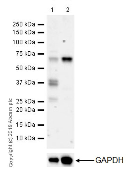 Western blot - Anti-YTHDF2 antibody [EPR20318] (AB220163), expandable thumbnail
