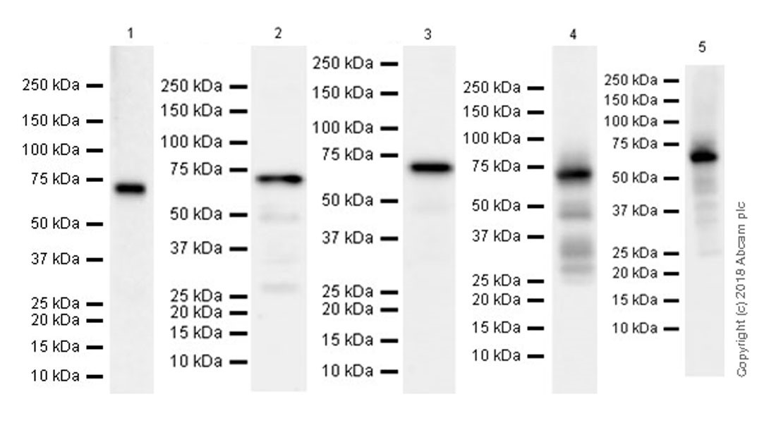 Western blot - Anti-YTHDF2 antibody [EPR20318] (AB220163), expandable thumbnail