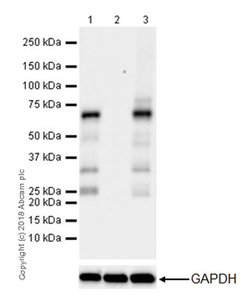 Western blot - Anti-YTHDF2 antibody [EPR20318] (AB220163), expandable thumbnail