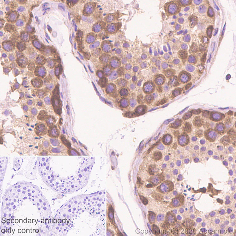 Immunohistochemistry (Formalin/PFA-fixed paraffin-embedded sections) - Anti-YTHDF2 antibody [EPR23544-19] - BSA and Azide free (AB275037)