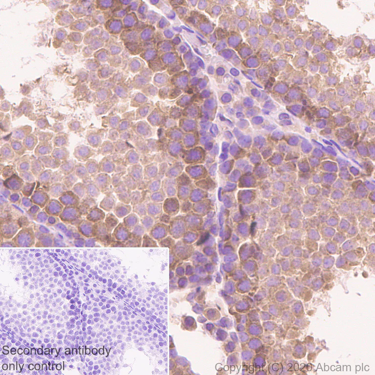 Immunohistochemistry (Formalin/PFA-fixed paraffin-embedded sections) - Anti-YTHDF2 antibody [EPR23544-19] - BSA and Azide free (AB275037)