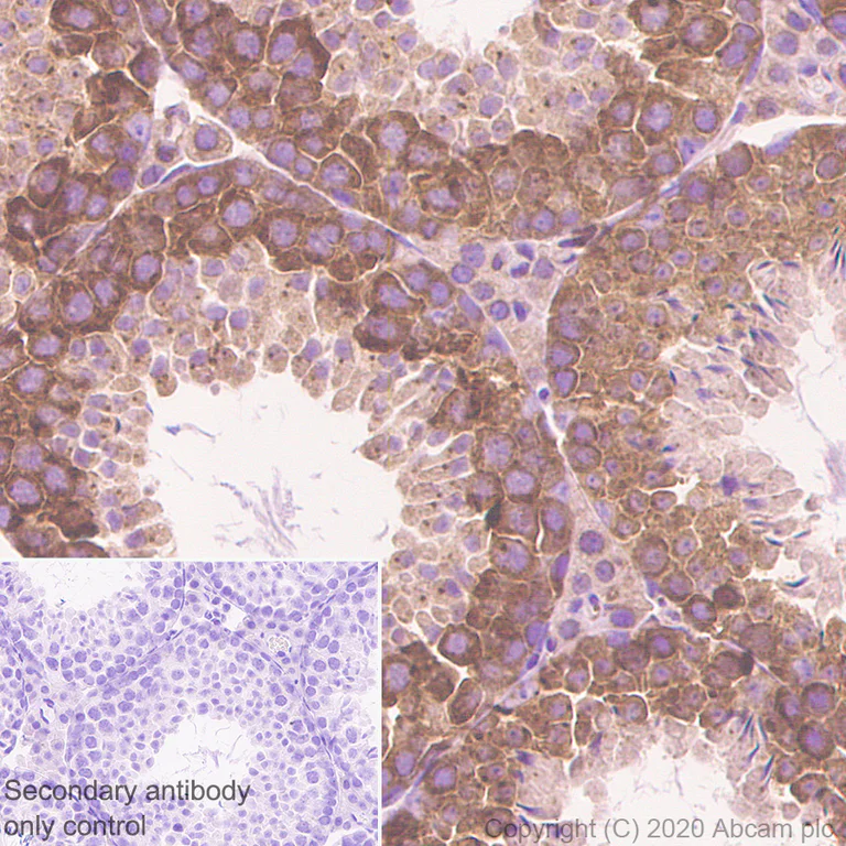 Immunohistochemistry (Formalin/PFA-fixed paraffin-embedded sections) - Anti-YTHDF2 antibody [EPR23544-19] - BSA and Azide free (AB275037)