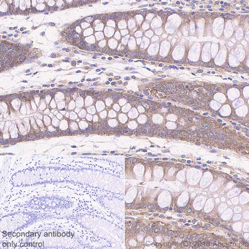 Immunohistochemistry (Formalin/PFA-fixed paraffin-embedded sections) - Anti-YTHDF3 antibody [EPR21912-3] (AB220161), expandable thumbnail