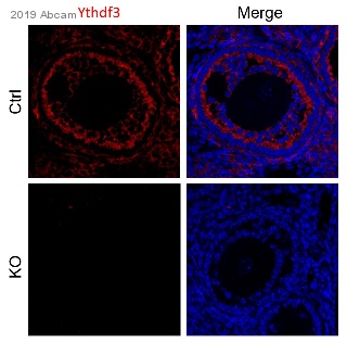 Immunohistochemistry (Formalin/PFA-fixed paraffin-embedded sections) - Anti-YTHDF3 antibody [EPR21912-3] (ab220161), expandable thumbnail