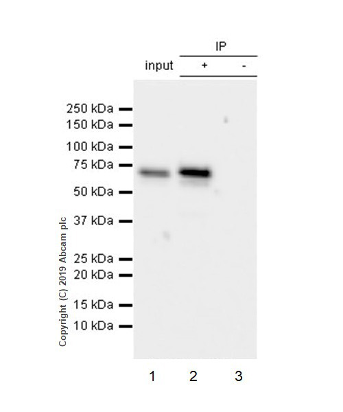 Immunoprecipitation - Anti-YTHDF3 antibody [EPR21912-3] (AB220161), expandable thumbnail