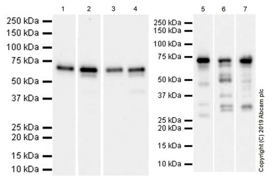 Western blot - Anti-YTHDF3 antibody [EPR21912-3] (ab220161), expandable thumbnail
