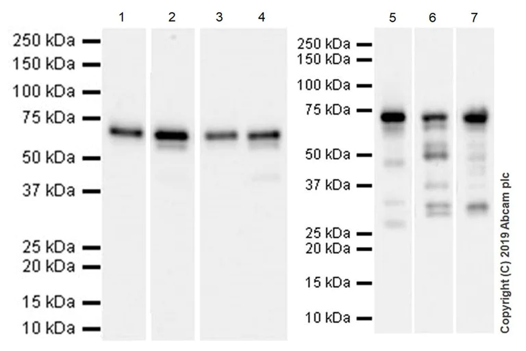 Western blot - Anti-YTHDF3 antibody [EPR21912-3] (AB220161)
