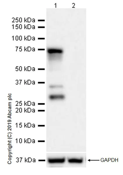 Western blot - Anti-YTHDF3 antibody [EPR21912-3] (AB220161)