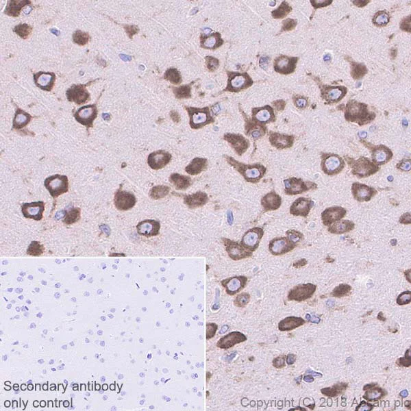 Immunohistochemistry (Formalin/PFA-fixed paraffin-embedded sections) - Anti-YTHDF3 antibody [EPR21912-3] - BSA and Azide free (AB255267)