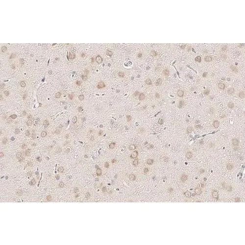 Immunohistochemistry (Formalin/PFA-fixed paraffin-embedded sections) - Anti-YTHDF3 antibody [HL2235] (AB317173)