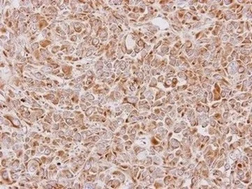 Immunohistochemistry (Formalin/PFA-fixed paraffin-embedded sections) - Anti-YWHAE antibody (AB137862)