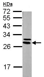 Western blot - Anti-YWHAE antibody (AB137862)
