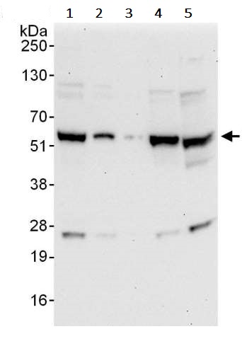 Western blot - Anti-YY1 antibody (AB245365), expandable thumbnail