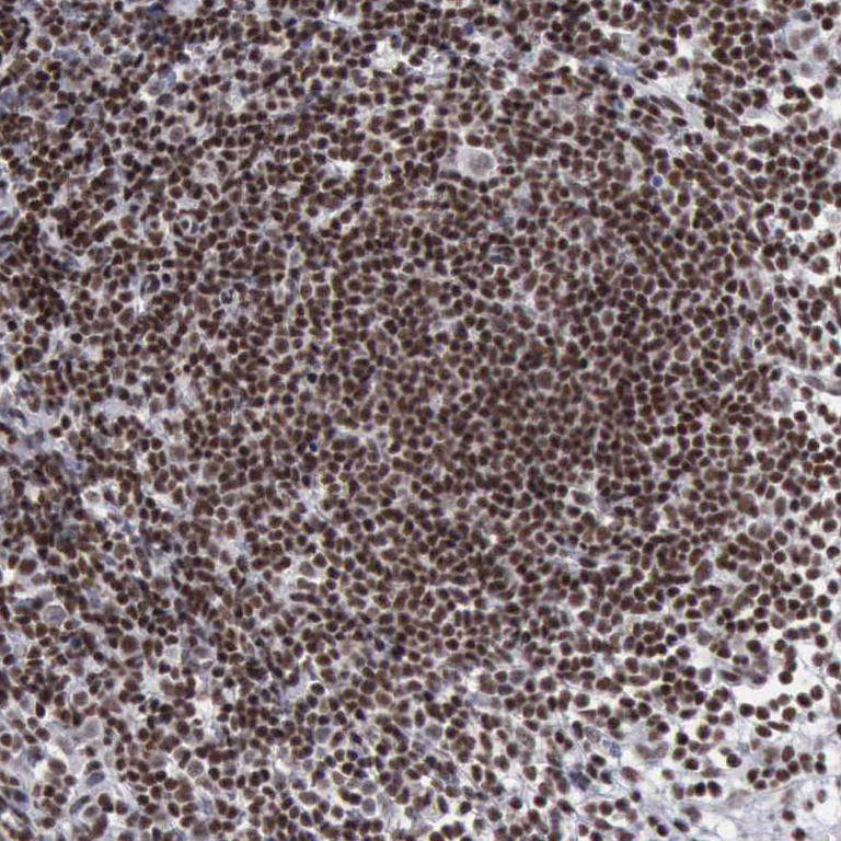 Immunohistochemistry (Formalin/PFA-fixed paraffin-embedded sections) - Anti-YY1 Antibody (AB327167)