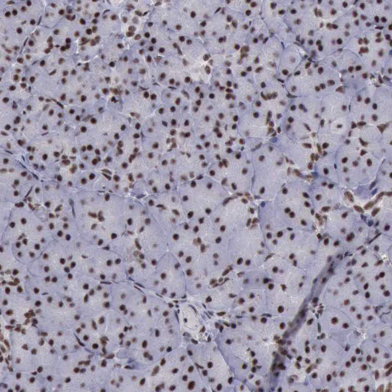 Immunohistochemistry (Formalin/PFA-fixed paraffin-embedded sections) - Anti-YY1 Antibody (AB327167)