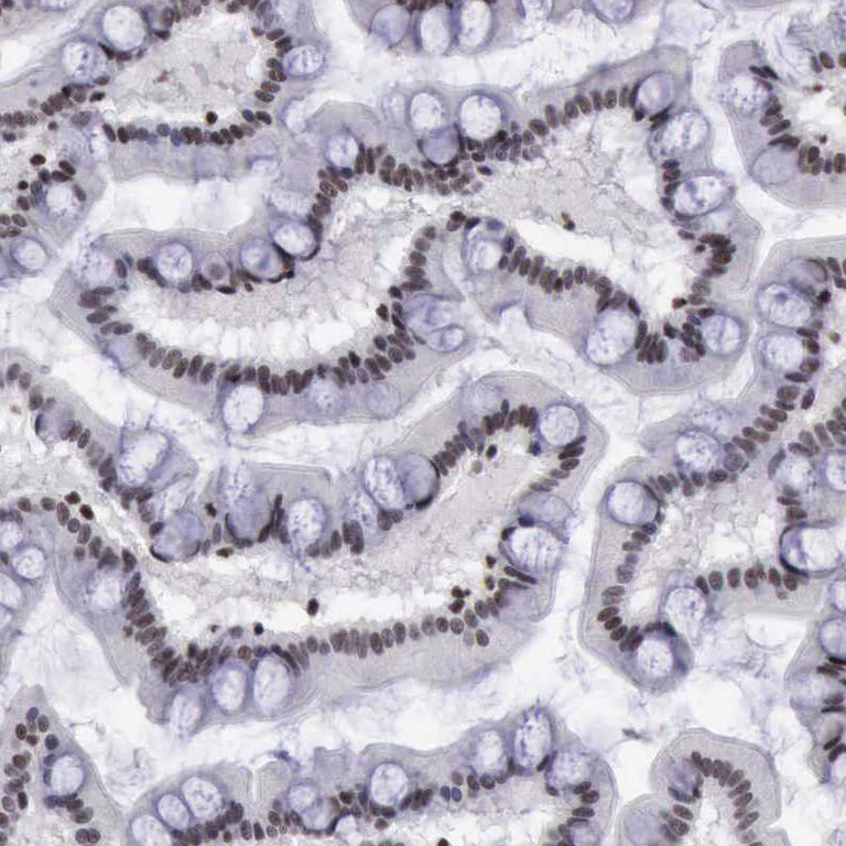 Immunohistochemistry (Formalin/PFA-fixed paraffin-embedded sections) - Anti-YY1 Antibody (AB327167)