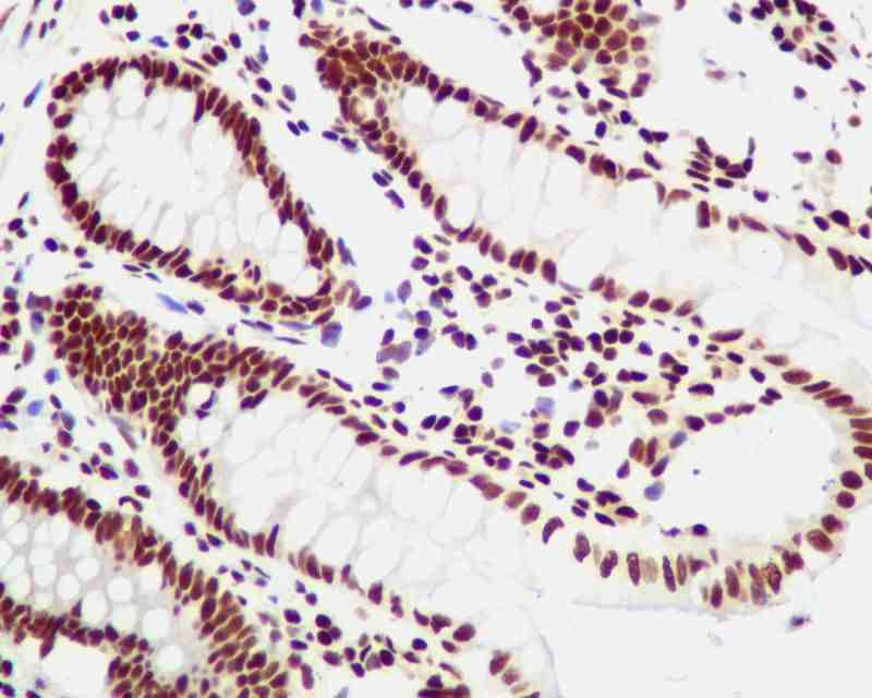 Immunohistochemistry (Formalin/PFA-fixed paraffin-embedded sections) - Anti-YY1 antibody [EPR4651] (AB109228), expandable thumbnail