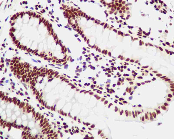 Immunohistochemistry (Formalin/PFA-fixed paraffin-embedded sections) - Anti-YY1 antibody [EPR4651] - BSA and Azide free (AB239956), expandable thumbnail