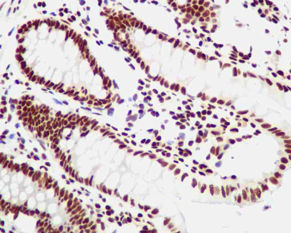 Immunohistochemistry (Formalin/PFA-fixed paraffin-embedded sections) - Anti-YY1 antibody [EPR4651] - Nuclear Loading Control (AB109228)