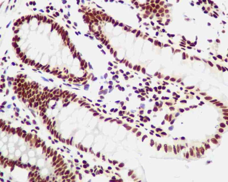 Immunohistochemistry (Formalin/PFA-fixed paraffin-embedded sections) - Anti-YY1 antibody [EPR4651] - Nuclear Loading Control (AB109228)