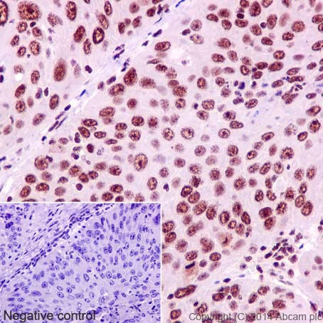 Immunohistochemistry (Formalin/PFA-fixed paraffin-embedded sections) - Anti-YY1 antibody [EPR4652] - Nuclear Loading Control (AB109237), expandable thumbnail