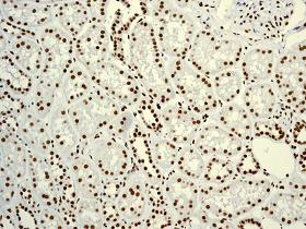 Immunohistochemistry (Formalin/PFA-fixed paraffin-embedded sections) - Anti-YY1 antibody [EPR4652] - Nuclear Loading Control (ab109237), expandable thumbnail