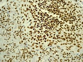 Immunohistochemistry (Formalin/PFA-fixed paraffin-embedded sections) - Anti-YY1 antibody [EPR4652] - Nuclear Loading Control (ab109237), expandable thumbnail