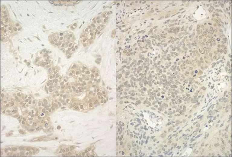 Immunohistochemistry (Formalin/PFA-fixed paraffin-embedded sections) - Anti-YY1 antibody - Nuclear Loading Control (AB245365)