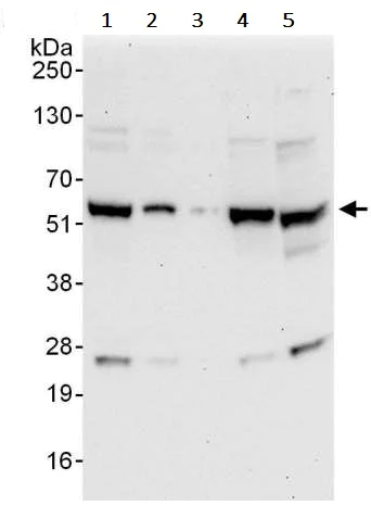 Western blot - Anti-YY1 antibody - Nuclear Loading Control (AB245365)