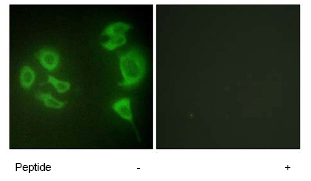 Immunocytochemistry/ Immunofluorescence - Anti-ZAK antibody (AB65249)