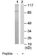 AB様 確認用 Anti-ZAK antibody (ab65249) | Abcam