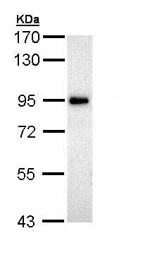 Western blot - Anti-ZAK antibody - N-terminal (AB154602)
