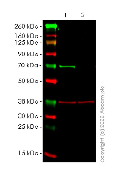 Western blot - Anti-ZAP70 antibody [29/ZAP70 Kinase] (AB302821)