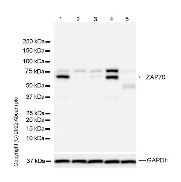 Western blot - Anti-ZAP70 antibody [29/ZAP70 Kinase] (BSA and Azide free) (AB302822)