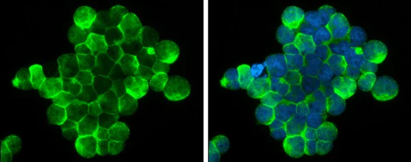 Immunocytochemistry/ Immunofluorescence - Anti-ZAP70 antibody (AB227237)