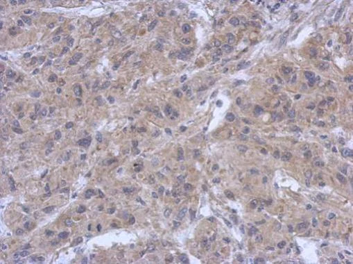 Immunohistochemistry (Formalin/PFA-fixed paraffin-embedded sections) - Anti-ZAP70 antibody (AB227237)
